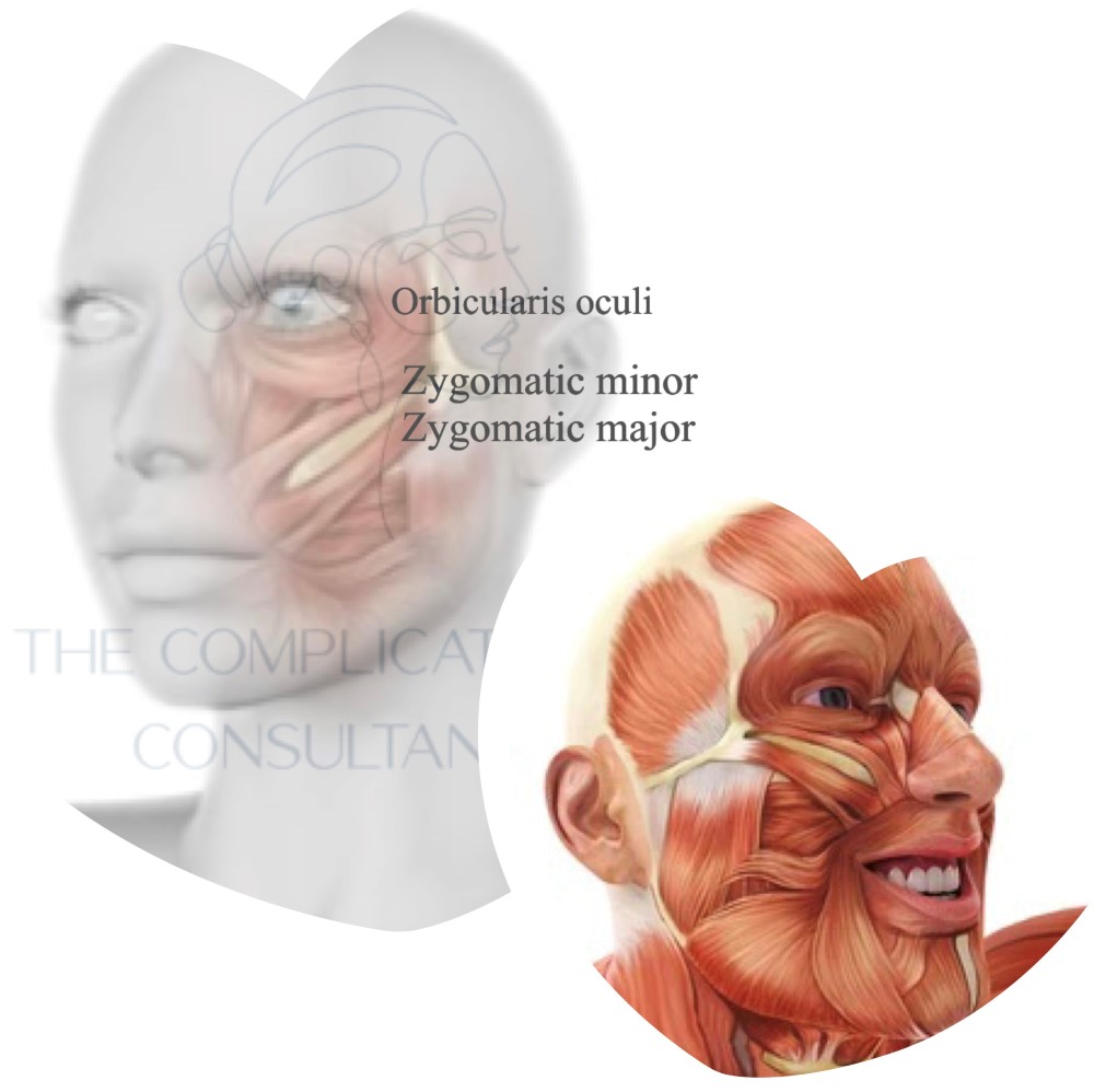 Botulinum Toxin Complications Management Course Causes The