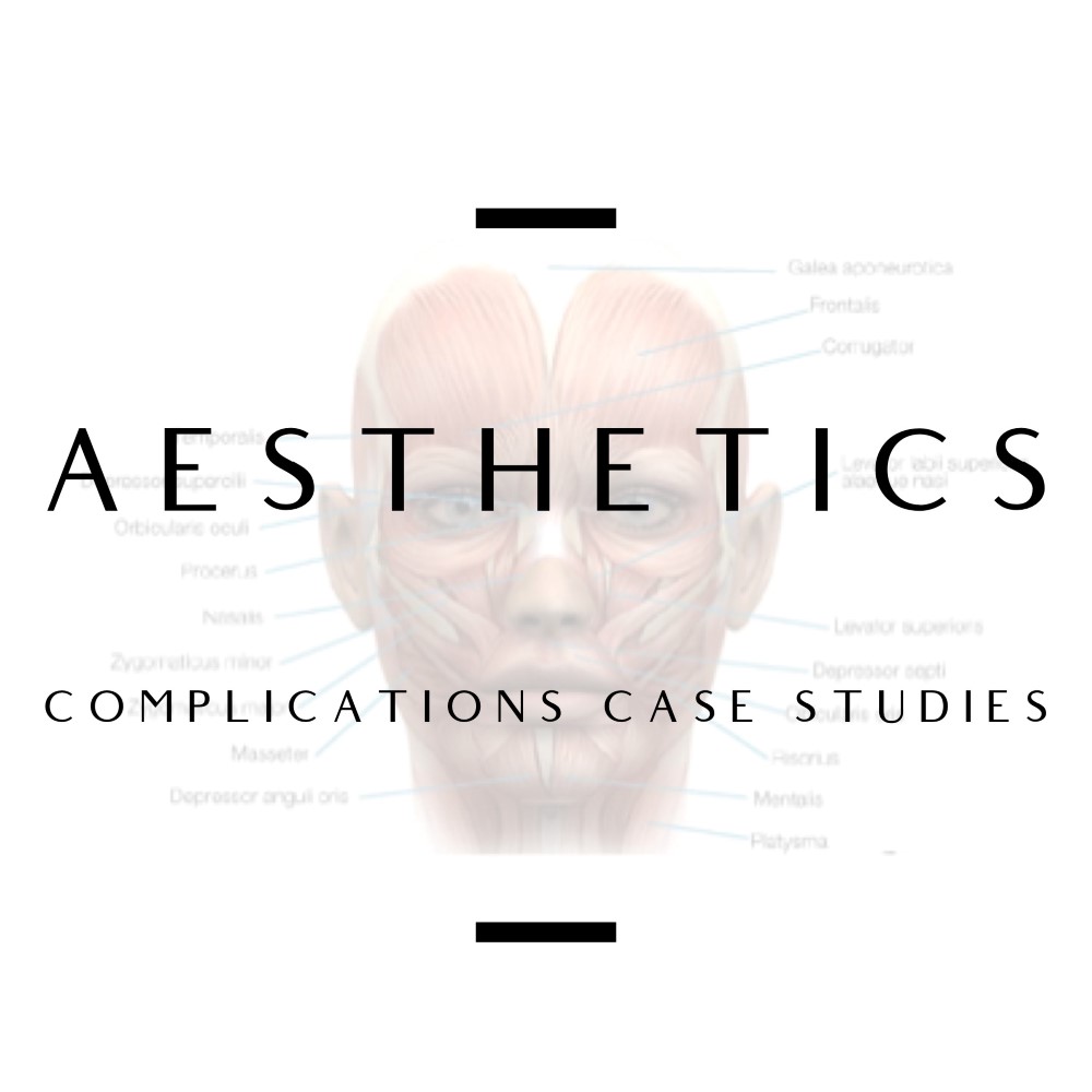 Aesthetics: Complications Case Studies